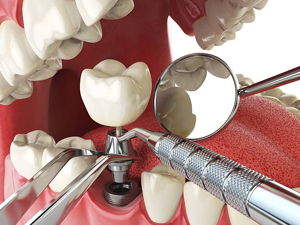 Best Emergency Dentist for Special Needs Patients in Vcennes, IN